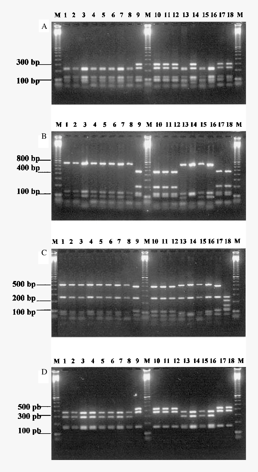 Pcr Rflp Of The 16s 23s Rdna Spacer Regions Digested - Architecture, HD Png Download, Free Download