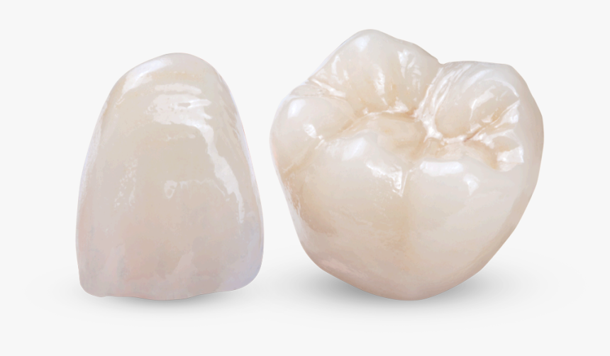 Obsidian All-ceramic Restorations For Bridges, Crowns - Sculpture, HD Png Download, Free Download