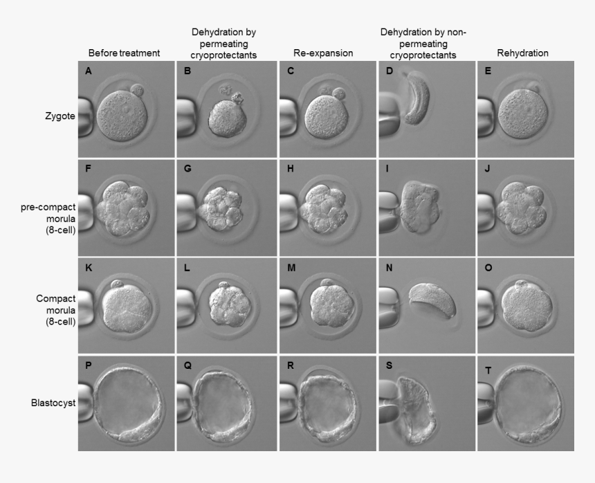 Embryo Cryopreservation, HD Png Download, Free Download
