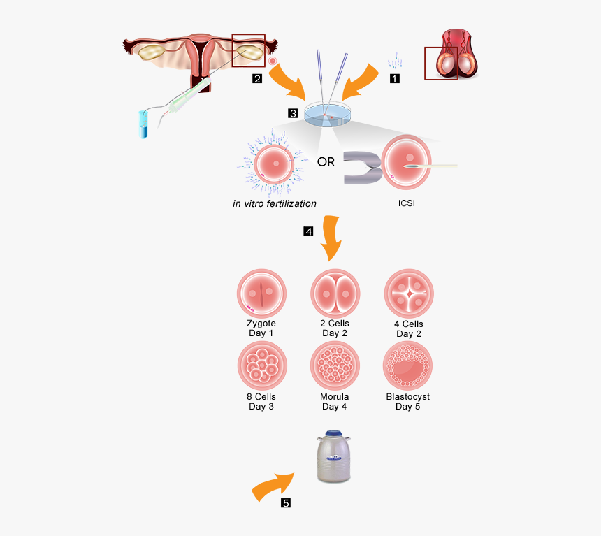 Embryo Banking Procedure - Egg Donation Process Uk, HD Png Download, Free Download