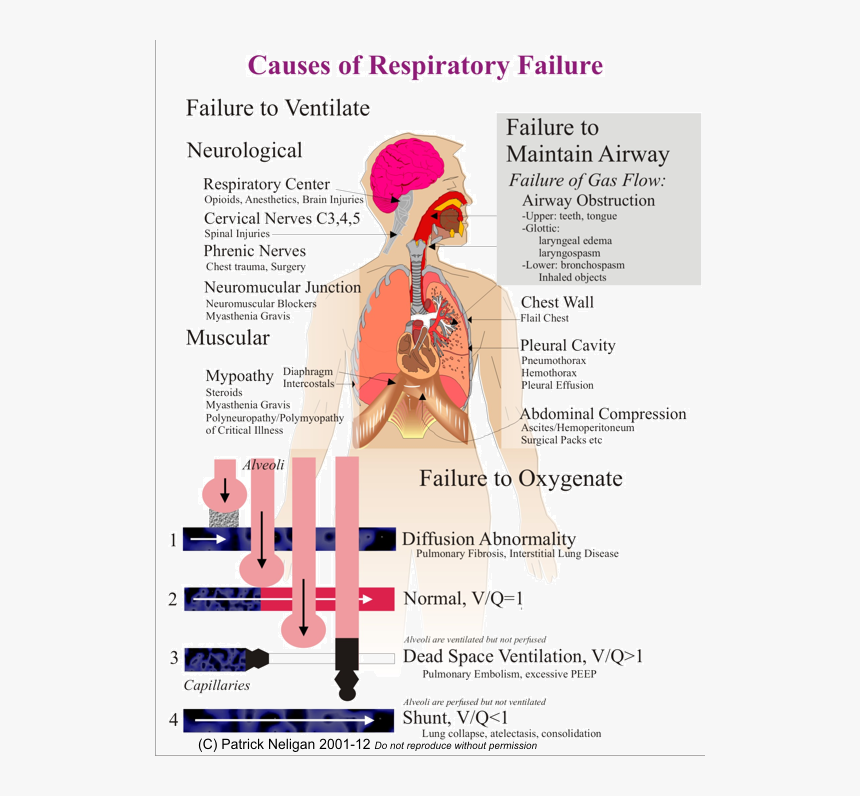 Causes Of Respiratory System, HD Png Download, Free Download