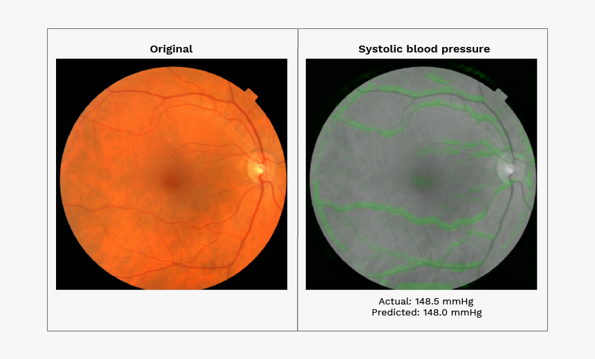 Prediction Of Cardiovascular Risk Factors From Retinal, HD Png Download, Free Download