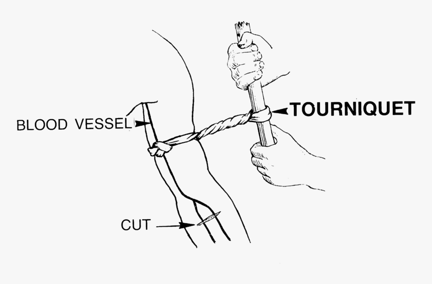 Tourniquet Locations In Arm, HD Png Download, Free Download