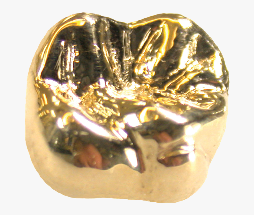 Золотые коронки 750 пробы. Сплав золота 750 пробы в стоматологии. Золотые зубные коронки. Цельнолитая коронка из золота.