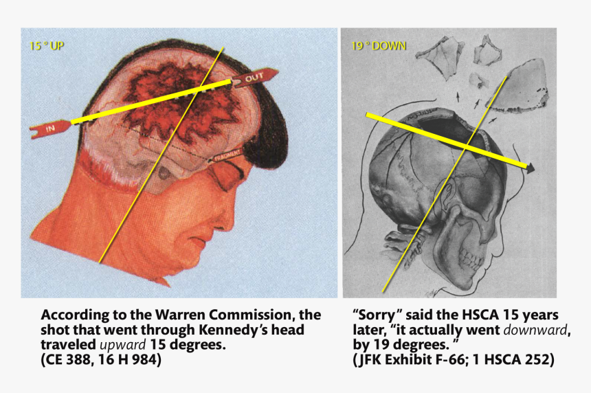 John F Kennedy Autopsy , Png Download - John Fitzgerald Kennedy Autopsy, Transparent Png, Free Download