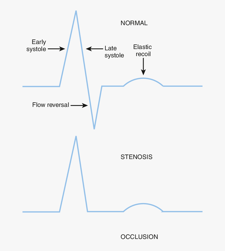 Diagram, HD Png Download, Free Download