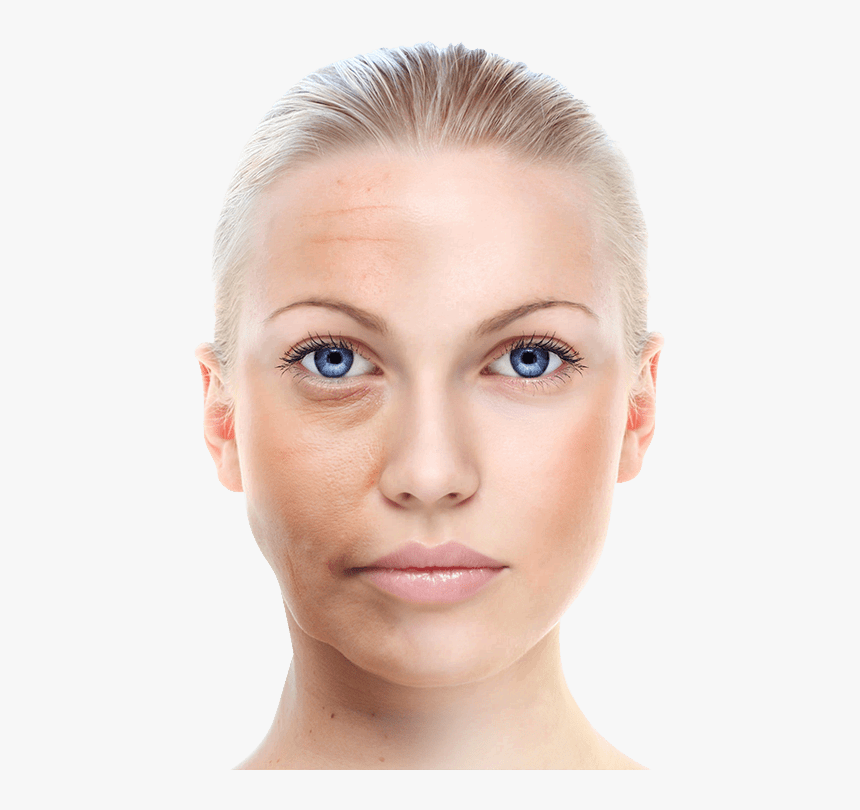 Wrinkle Skin Png, Transparent Png, Free Download