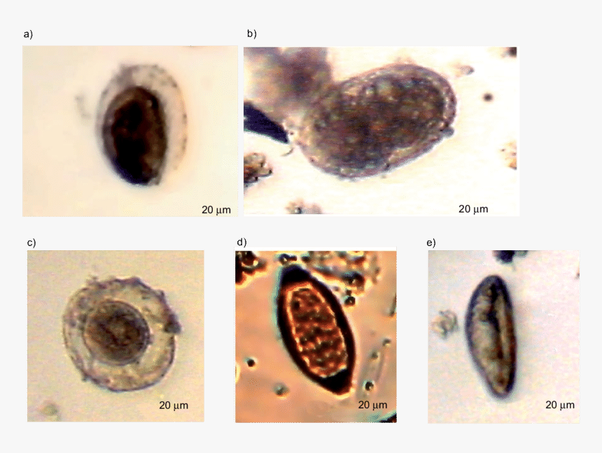 Huevos De Trichuris Trichiura, HD Png Download, Free Download