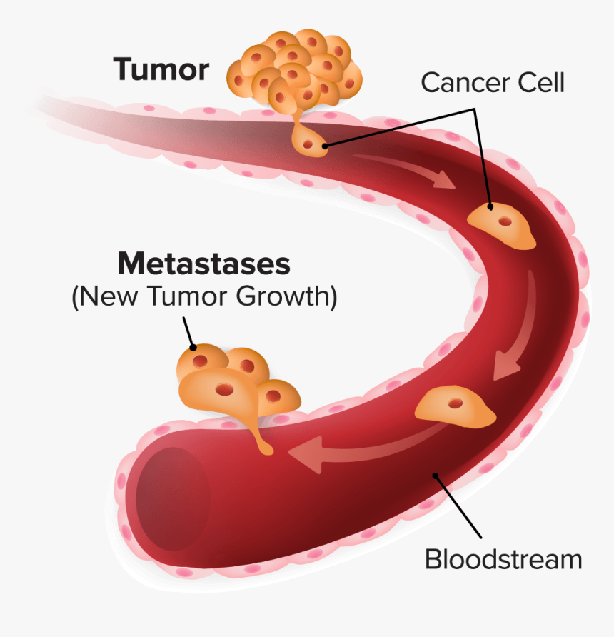 Metastasis - Circulating Tumor Cell Cartoon, HD Png Download, Free Download