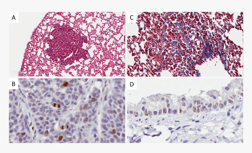 Lung Cancer Cell Proliferation Measured By Phospho, HD Png Download, Free Download