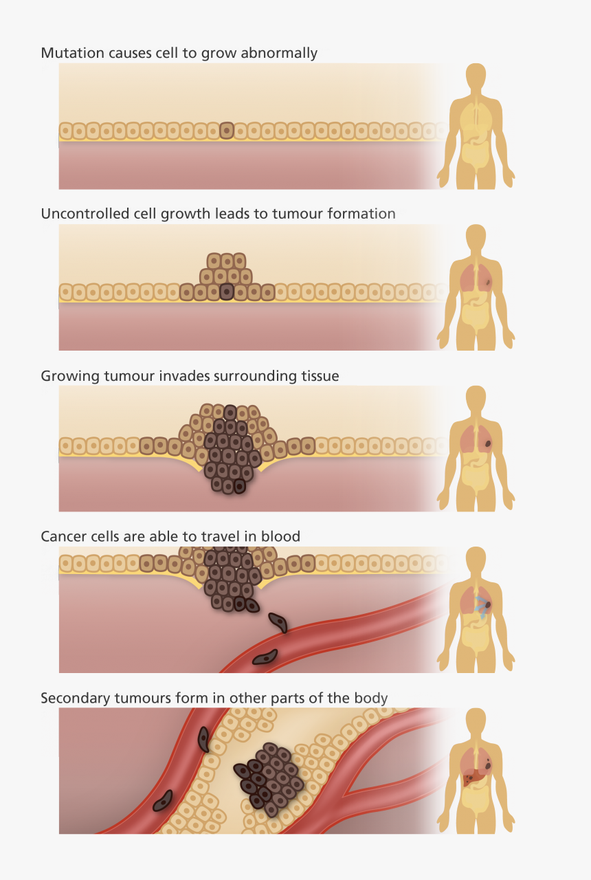 Illustration Showing How Uncontrolled Cell Growth Leads - Cancer A Genetic Disorder, HD Png Download, Free Download