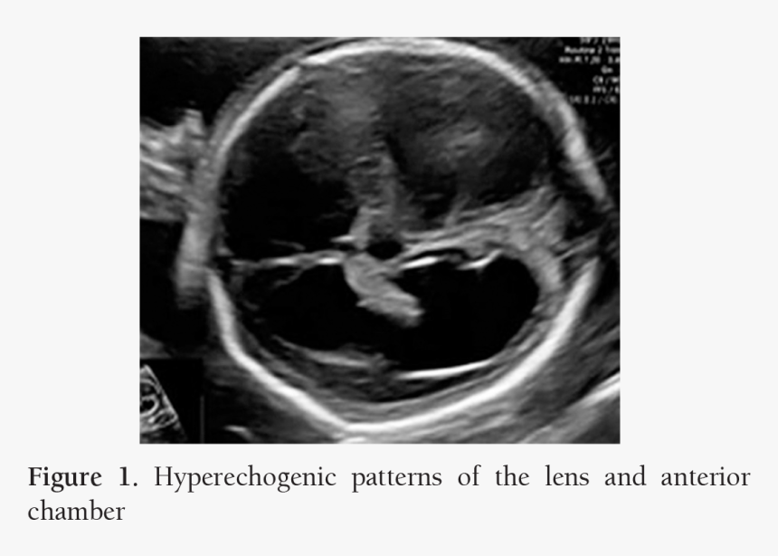 Computed Tomography, HD Png Download, Free Download