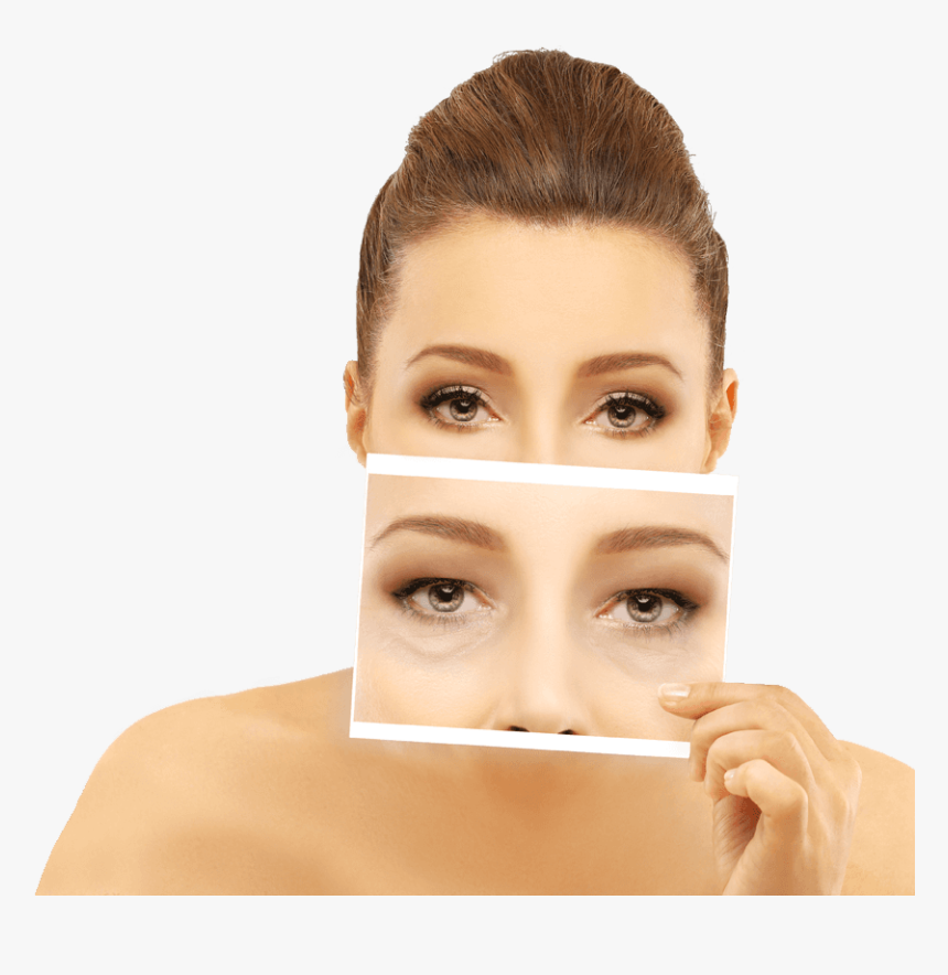 A Woman With Unwrinkled Eyes Holding Up A Photo Of - Eyelid Surgery, HD Png Download, Free Download