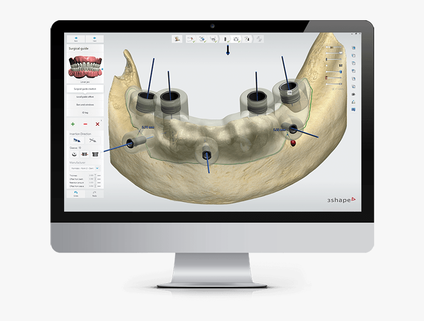 3shape Software, HD Png Download, Free Download