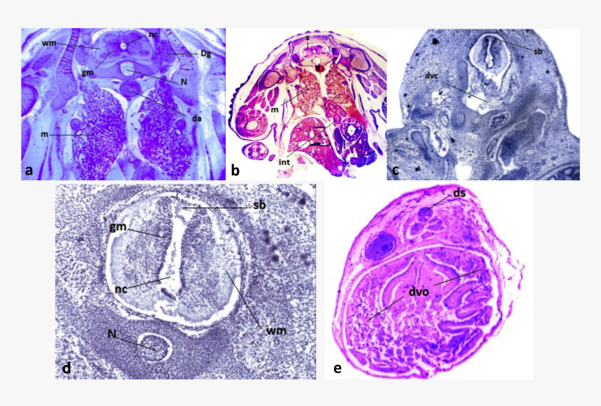 Computed Tomography, HD Png Download, Free Download