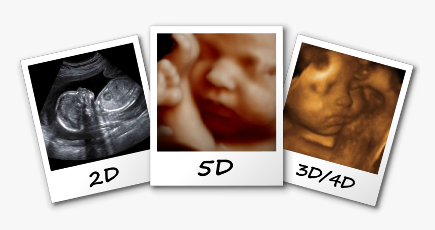 3d/4d/5d Ultrasound Fayetteville Nc Comparison Image - 3d 4d 5d Ultrasound, HD Png Download, Free Download