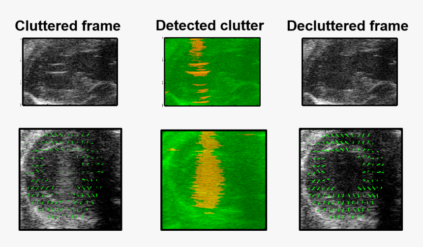 Clutter Reduction - Medical Imaging, HD Png Download, Free Download