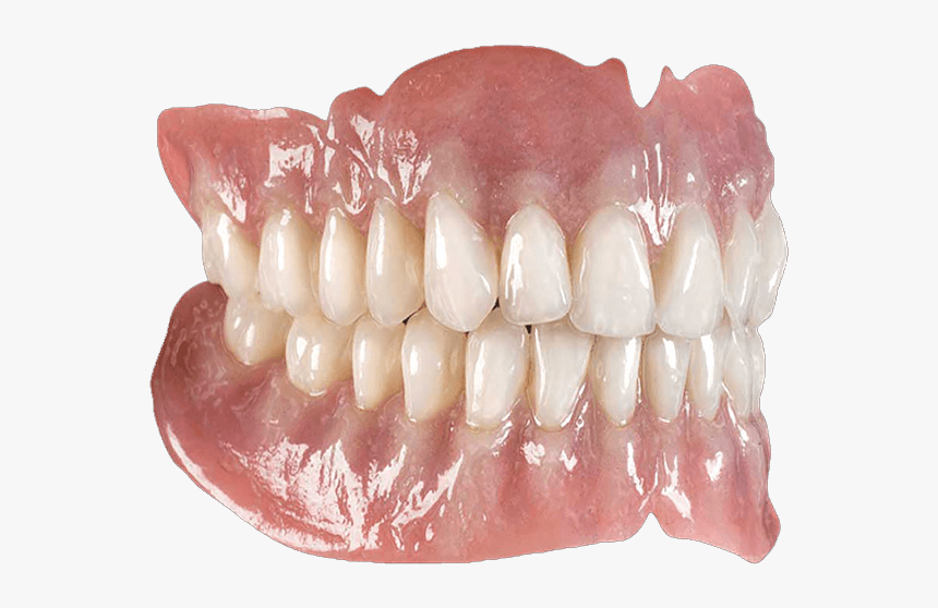 Implant Supported Dentures Are The Best Form Of False - Gingiva Ceramic, HD Png Download, Free Download