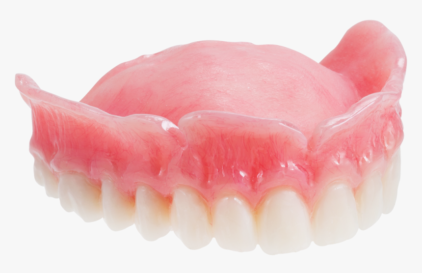 Maxillary Single Denture, HD Png Download, Free Download
