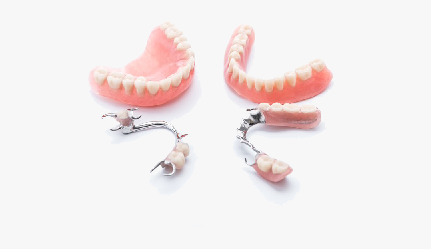 Partial-dentures - Types Of Dentures, HD Png Download, Free Download