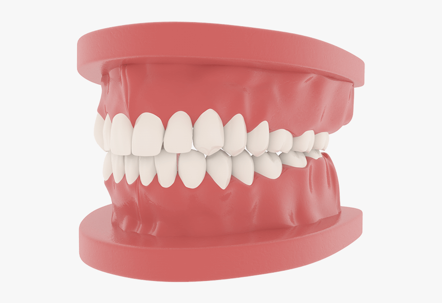 Full Mouth Denture Dentures Removable - Plastic, HD Png Download, Free Download