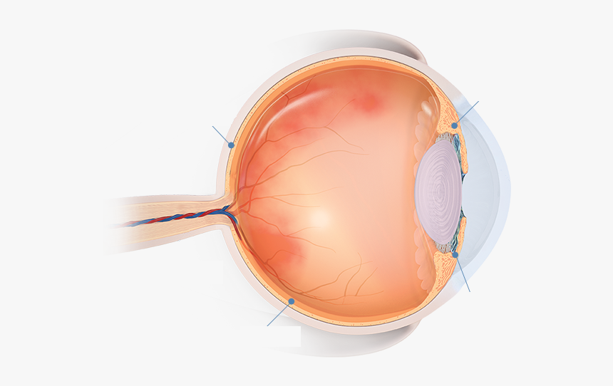 Areas Of The Eye Affected By Uveitis - Circle, HD Png Download, Free Download