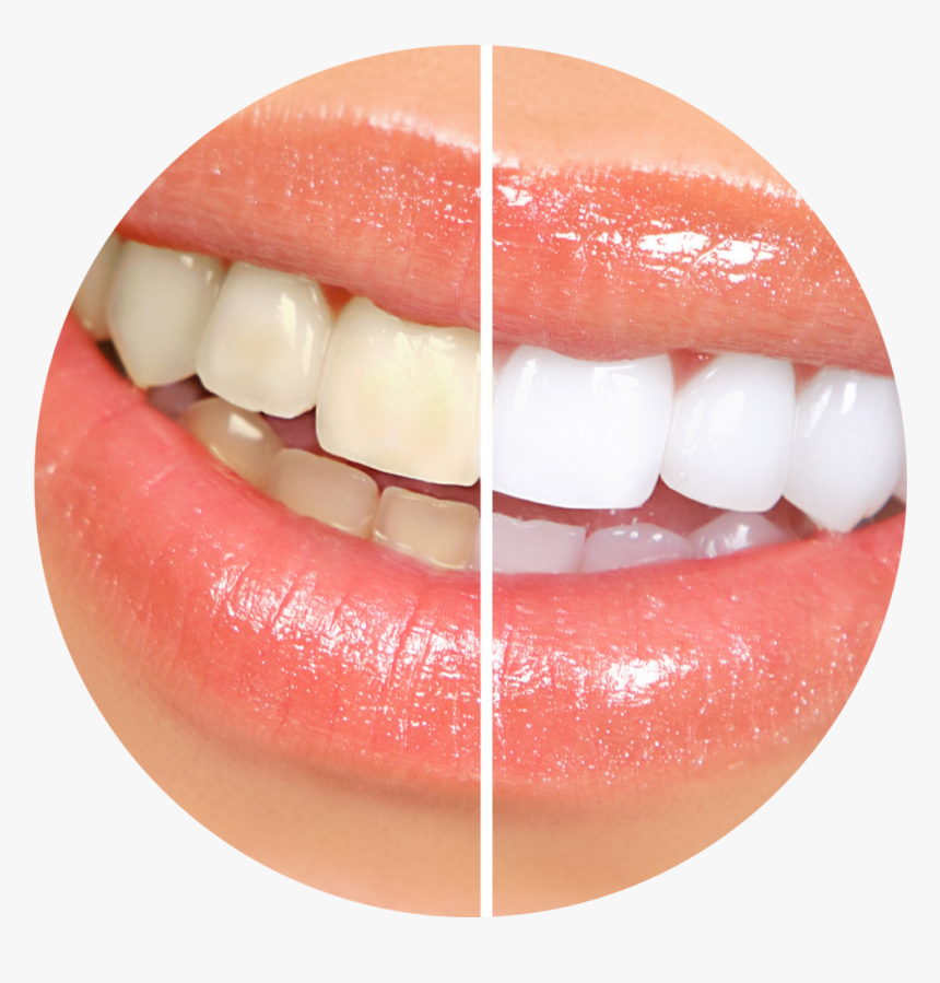 Teeth Smile Png, Transparent Png, Free Download