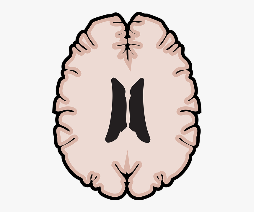 Brain Clipart , Png Download - Vector Graphics, Transparent Png, Free Download