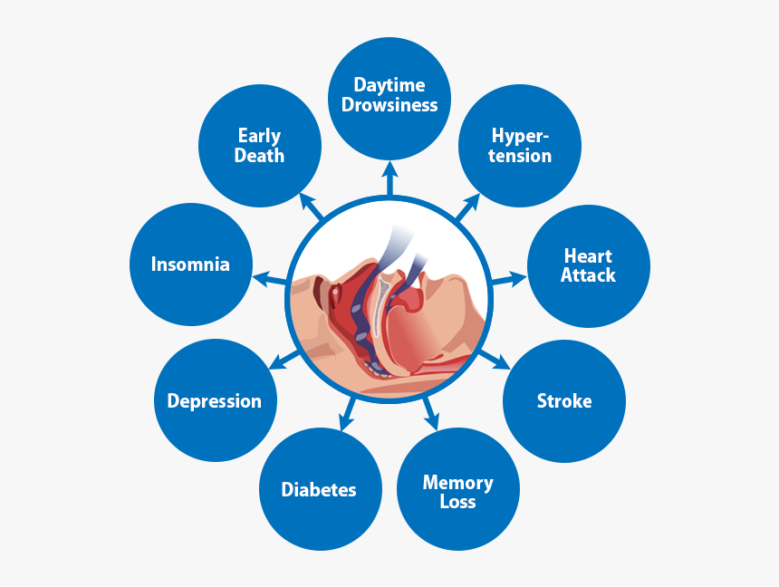 Risk Factor Of Osa, HD Png Download, Free Download