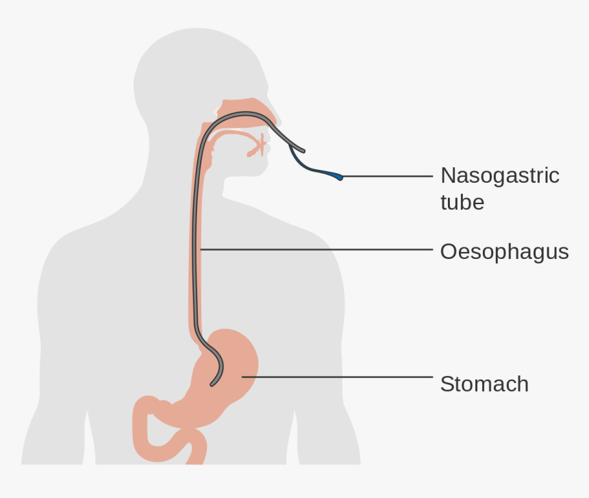 Nasogastric Tube Clipart, HD Png Download, Free Download