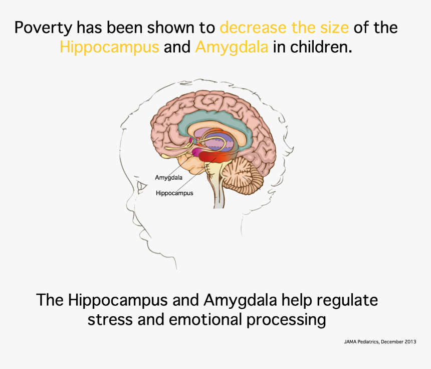 Child's Brain In Poverty, HD Png Download, Free Download