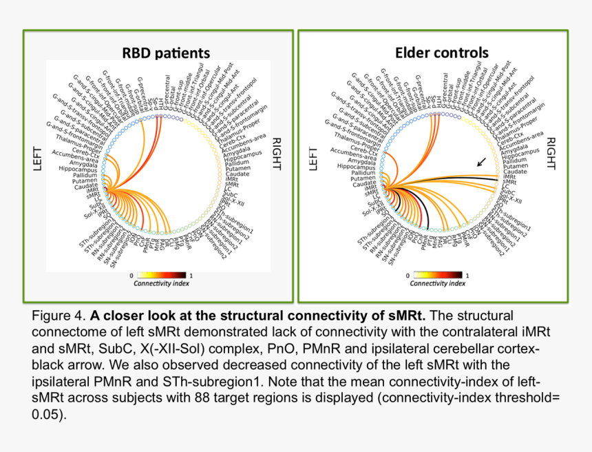 Figure4 - Circle, HD Png Download, Free Download