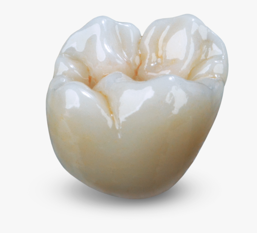 Monolithic Zirconia Crown, HD Png Download is free transparent png image. 