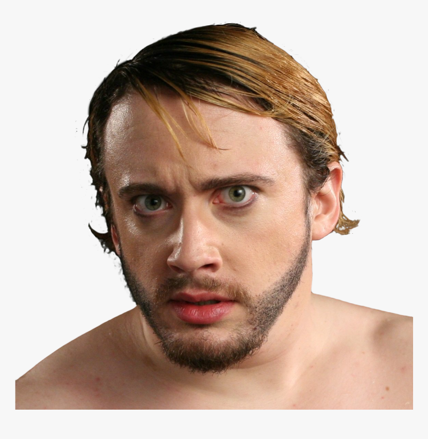 Sam Hyde Before And After, HD Png Download, Free Download