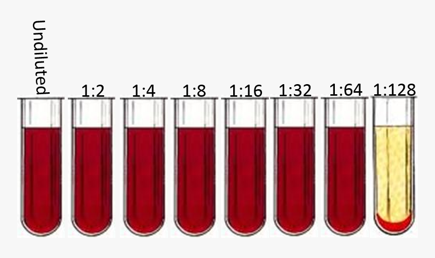 Complement Fixation Test - Valley Fever Blood Test, HD Png Download, Free Download