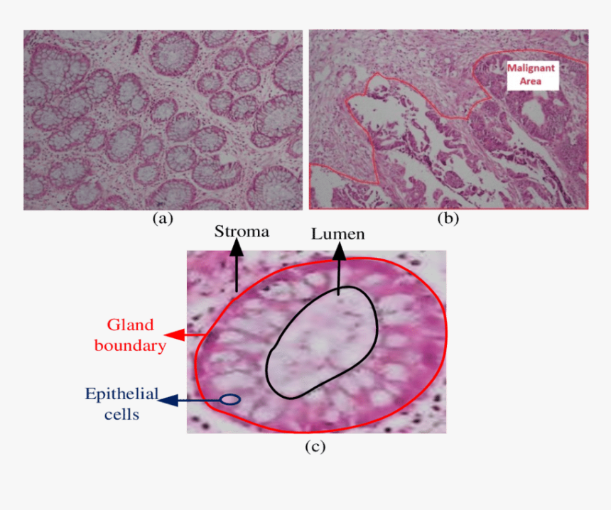 Transparent Microscopes Clipart - Structure Of Colon Tissue, HD Png Download, Free Download