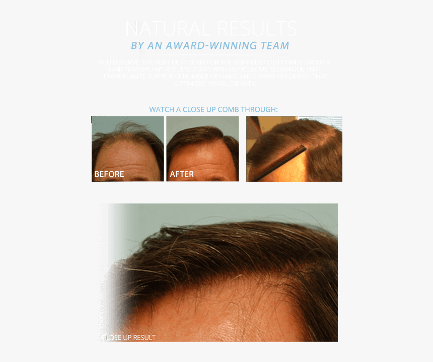 Lace Wig, HD Png Download, Free Download
