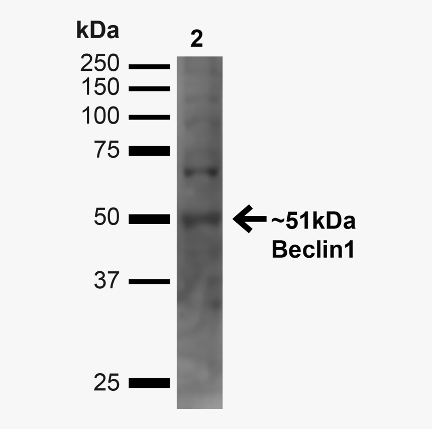 Western Blot - Buick 225, HD Png Download, Free Download