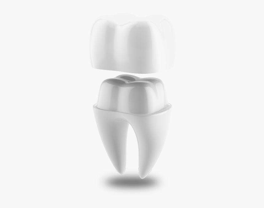 Dental Crown Model San Jose, Ca - Sculpture, HD Png Download, Free Download