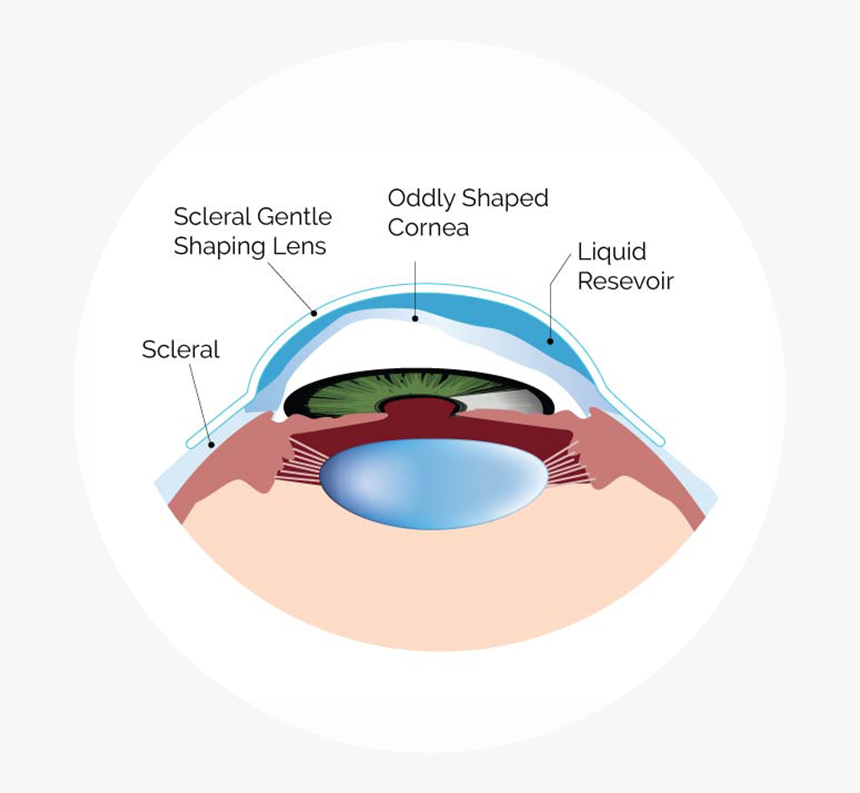 Optometrist, Type Of Scleral Lenses - Circle, HD Png Download, Free Download