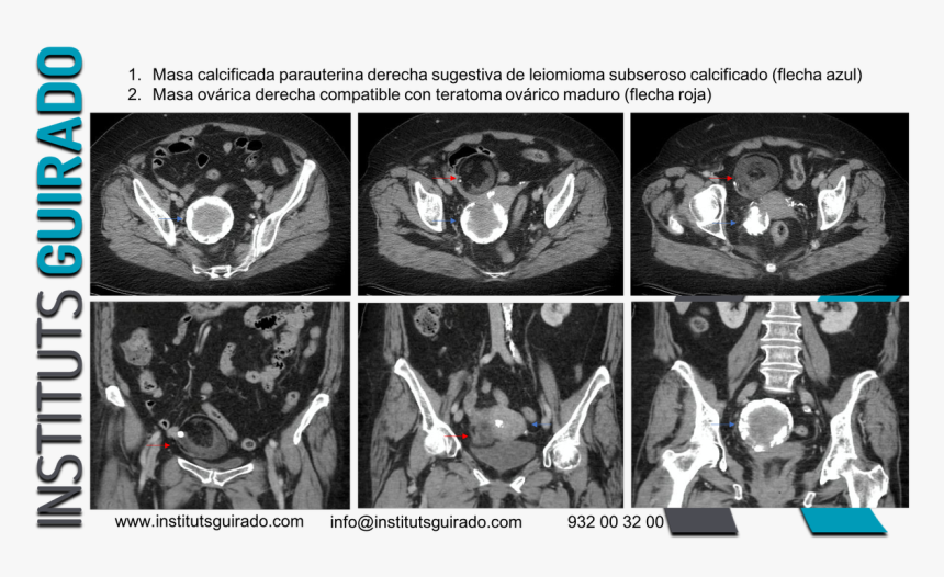 Computed Tomography, HD Png Download, Free Download