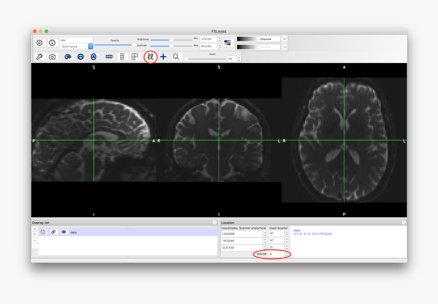 Fsl Tractography, HD Png Download, Free Download
