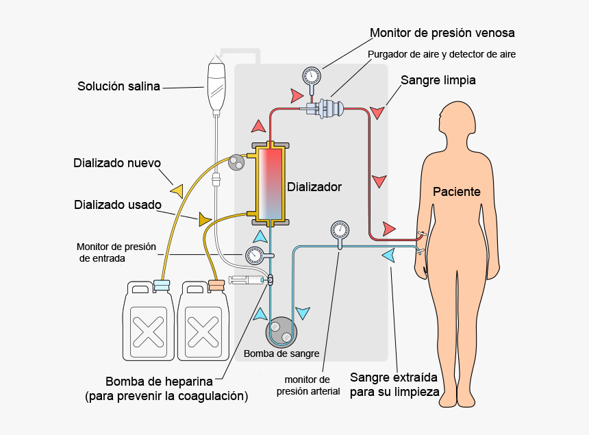 File - Hemodiálisis - Dialysis Pressure, HD Png Download, Free Download