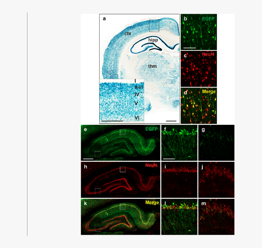 Raprnp Vector Drives Expression In Rat Neurons - Grass, HD Png Download, Free Download