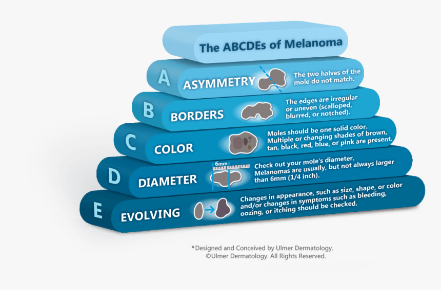 Mole Under A Microscope Melanoma, HD Png Download, Free Download