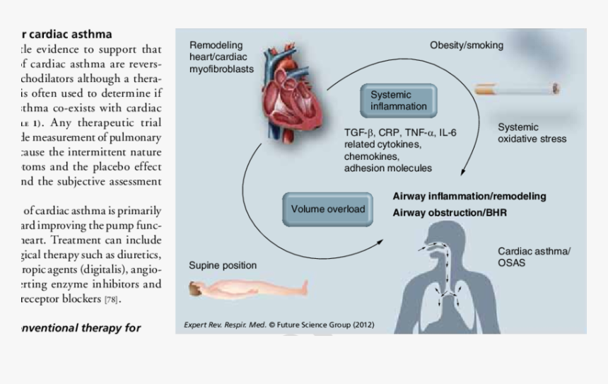 Does Volume Overload Cause Heart Failure, HD Png Download, Free Download