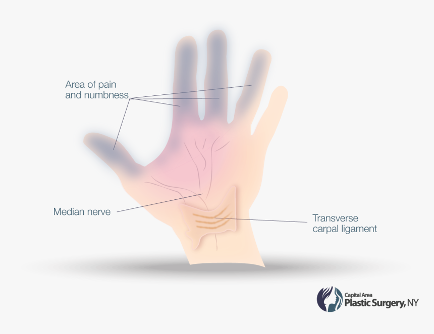 Diagram, HD Png Download, Free Download