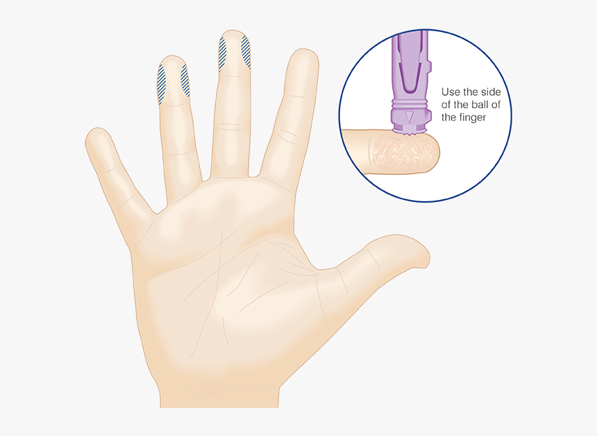 Finger Puncture, HD Png Download, Free Download