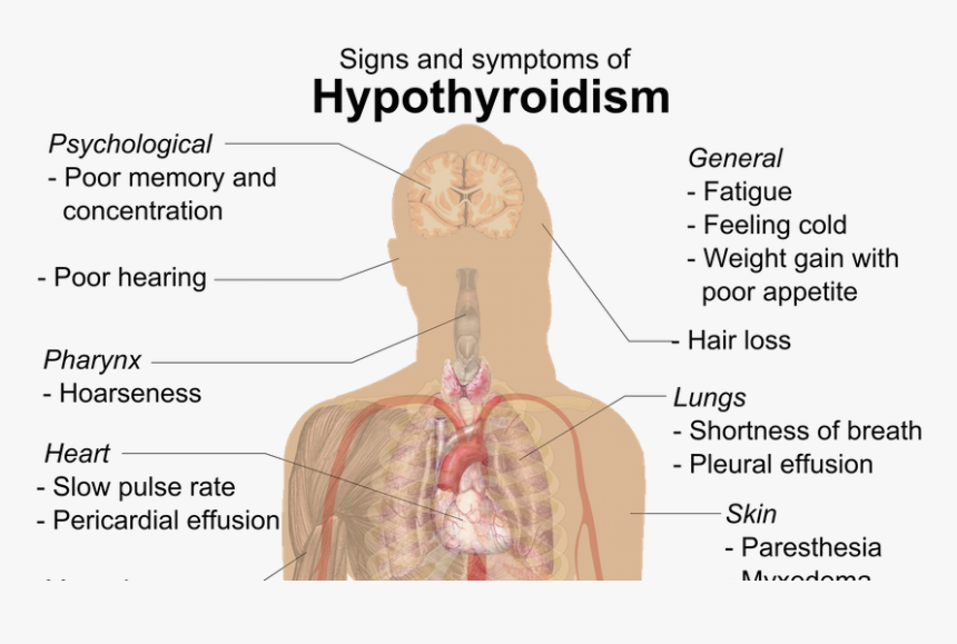 Hypothyroidism In Adults, HD Png Download, Free Download