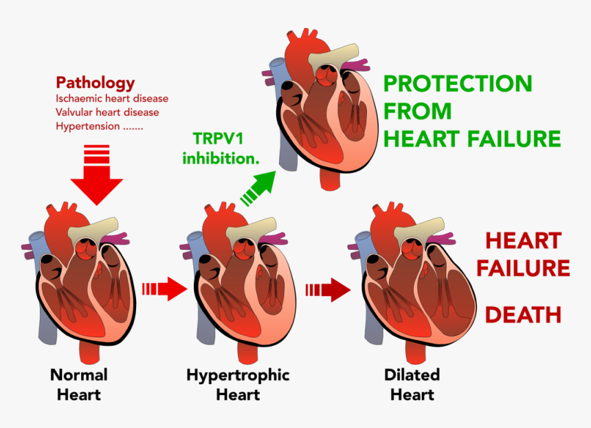 Png Transparent Stock Disease Clipart Heart Damage - Unlabeled Heart Diagram, Png Download, Free Download